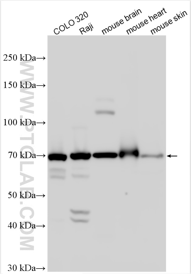 Western Blot (WB) analysis of various lysates using APCDD1 Polyclonal antibody (17024-1-AP)