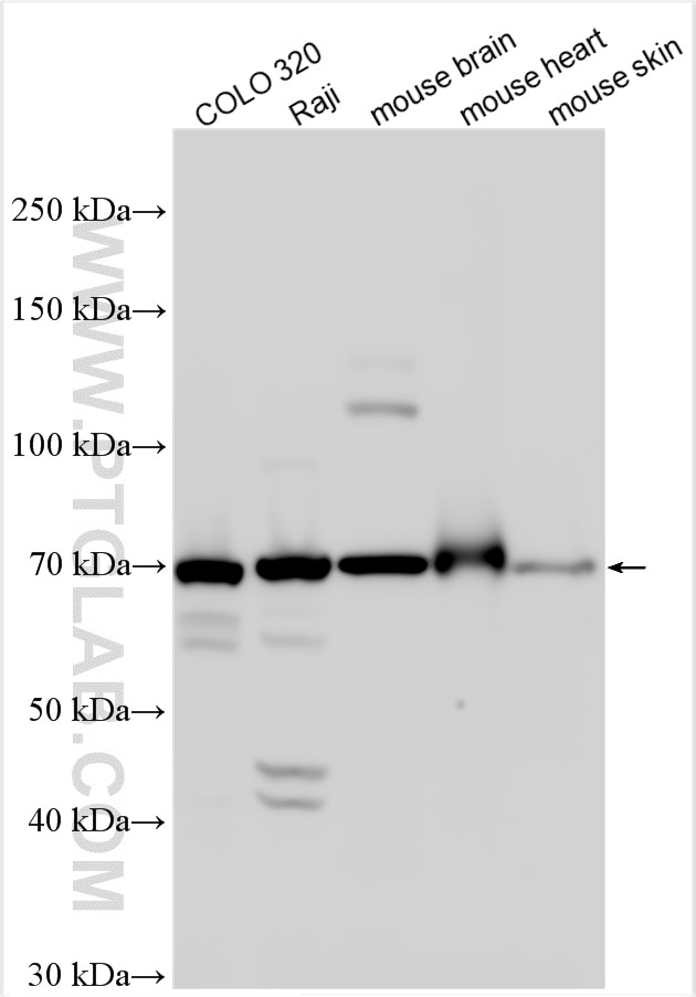 Western Blot (WB) analysis of various lysates using APCDD1 Polyclonal antibody (17024-1-AP)