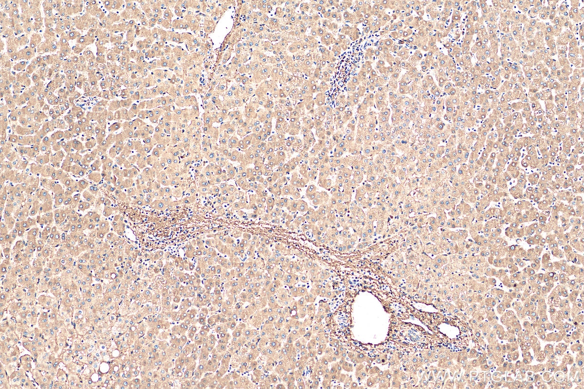 Immunohistochemistry (IHC) staining of human liver tissue using Serum amyloid P component Polyclonal antibody (20773-1-AP)