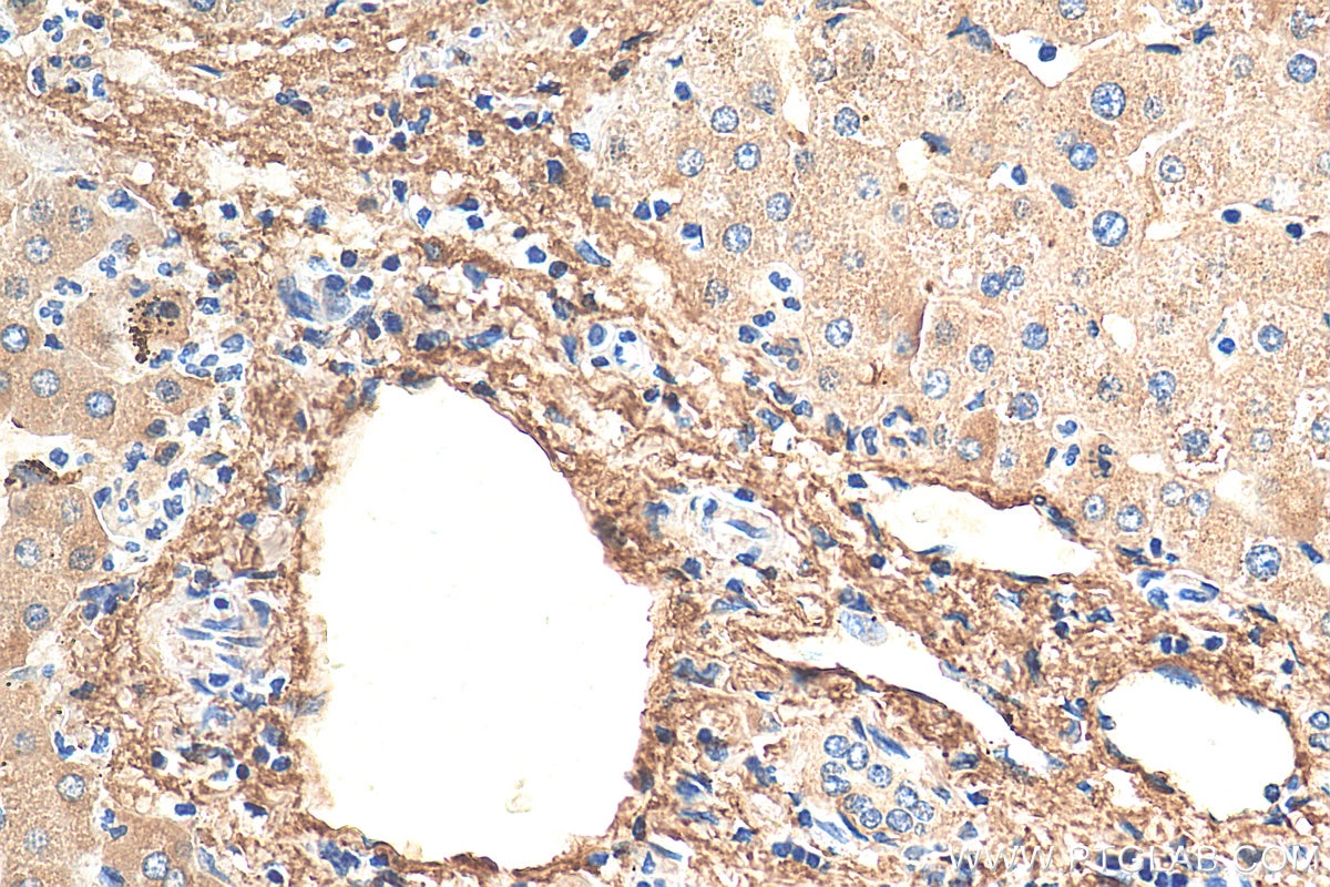 Immunohistochemistry (IHC) staining of human liver tissue using Serum amyloid P component Polyclonal antibody (20773-1-AP)