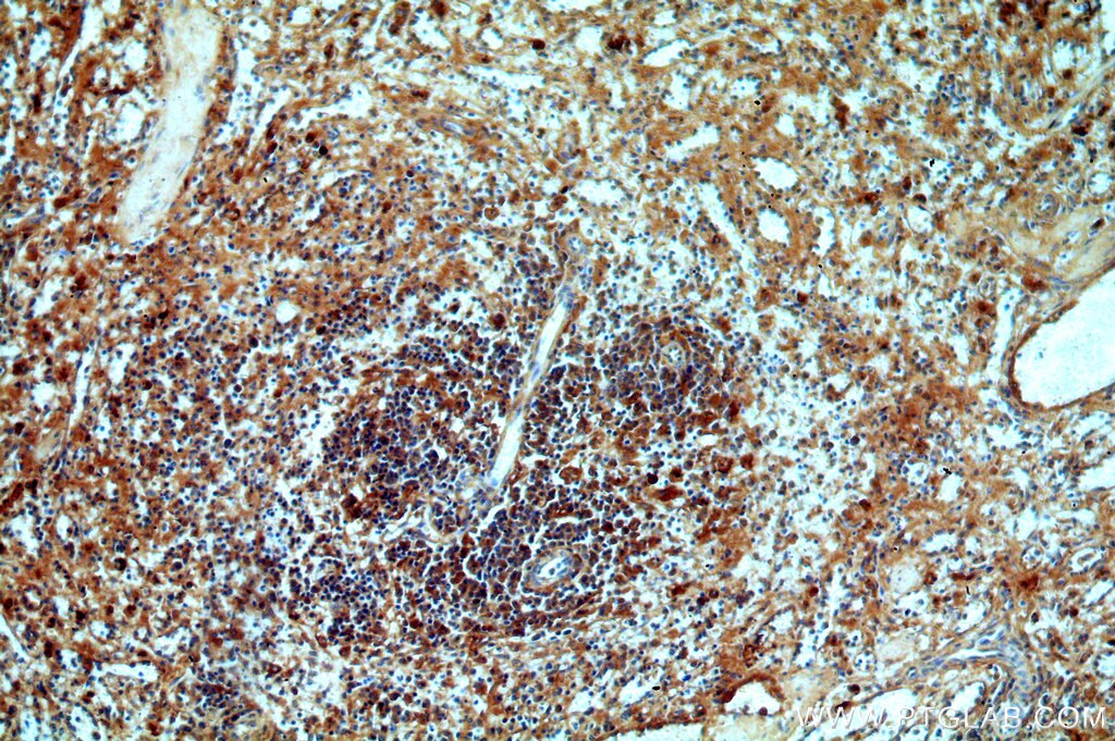 Immunohistochemistry (IHC) staining of human spleen tissue using Serum amyloid P component Polyclonal antibody (20773-1-AP)