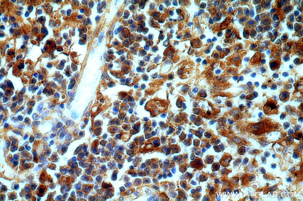 Immunohistochemistry (IHC) staining of human spleen tissue using Serum amyloid P component Polyclonal antibody (20773-1-AP)