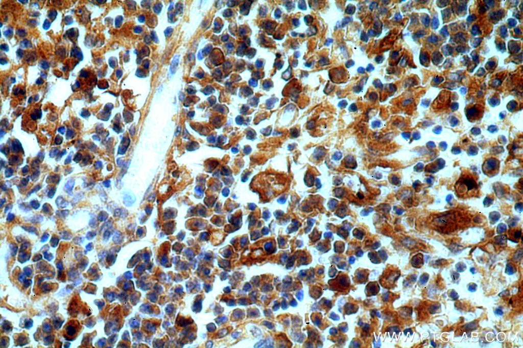 IHC staining of human spleen using 20773-1-AP