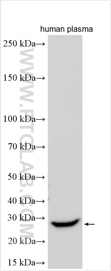 WB analysis using 20773-1-AP Western Blot (WB) analysis of various lysates using Serum amyloid P component Polyclonal antibody (20773-1-AP)