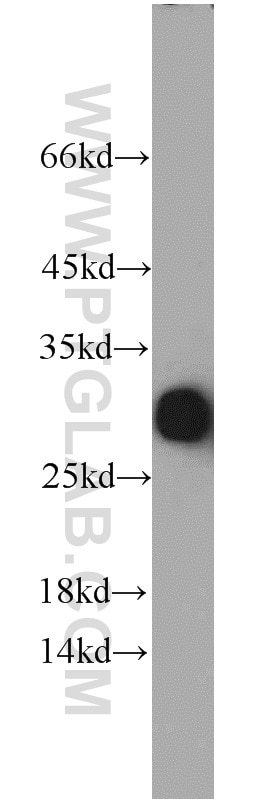 Western Blot (WB) analysis of human kidney tissue using Serum amyloid P component Polyclonal antibody (20773-1-AP)