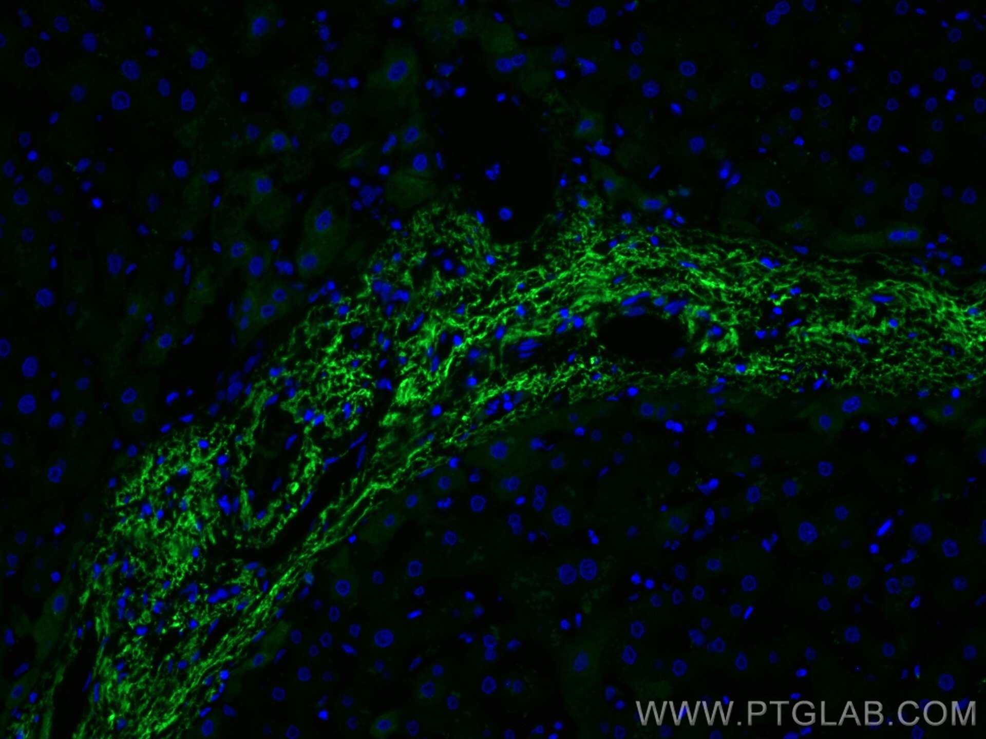 Immunofluorescence (IF) / fluorescent staining of human liver tissue using Serum amyloid P component Monoclonal antibody (66084-1-Ig)