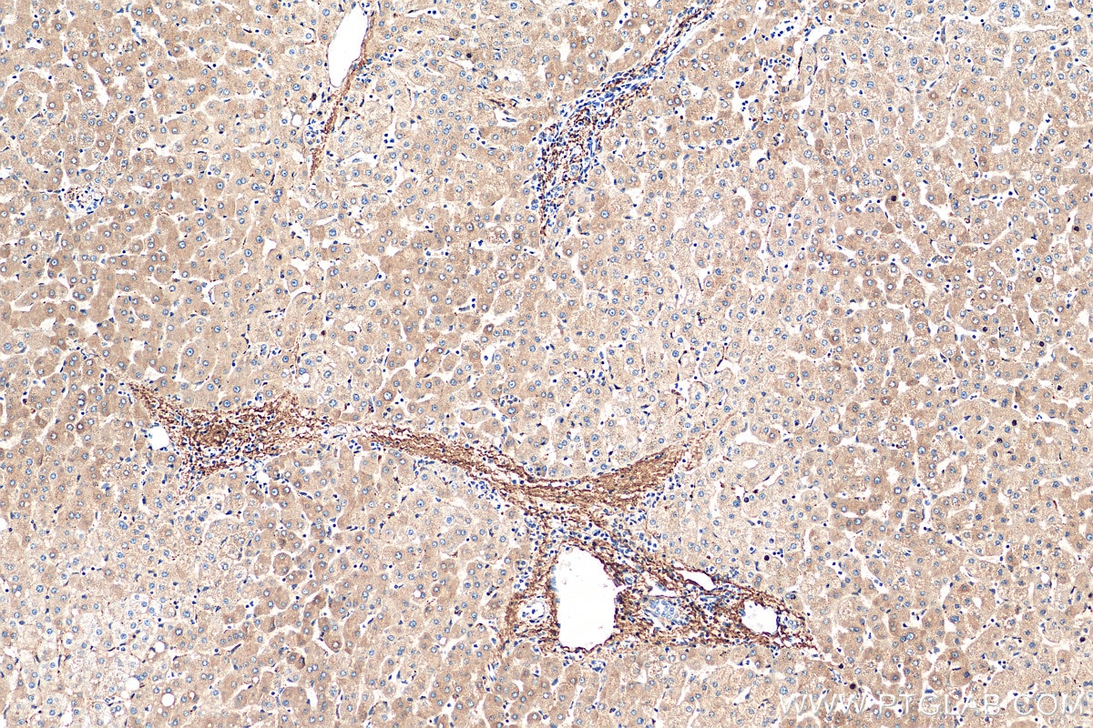 Immunohistochemistry (IHC) staining of human liver tissue using Serum amyloid P component Monoclonal antibody (66084-1-Ig)