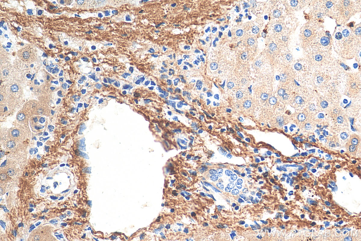 Immunohistochemistry (IHC) staining of human liver tissue using Serum amyloid P component Monoclonal antibody (66084-1-Ig)