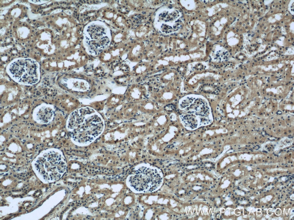 Immunohistochemistry (IHC) staining of human kidney tissue using Serum amyloid P component Monoclonal antibody (66084-1-Ig)