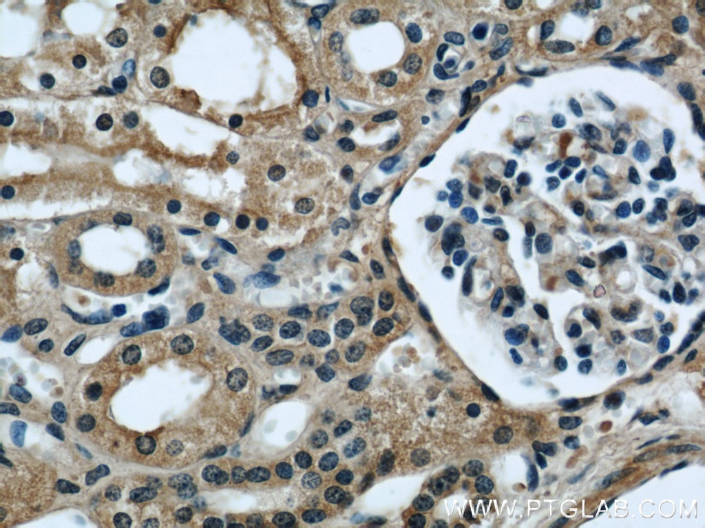 Immunohistochemistry (IHC) staining of human kidney tissue using Serum amyloid P component Monoclonal antibody (66084-1-Ig)
