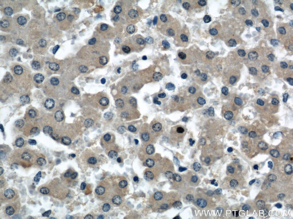 IHC staining of human liver using 66084-1-Ig