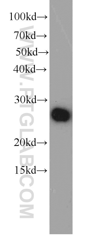 Western Blot (WB) analysis of human plasma using Serum amyloid P component Monoclonal antibody (66084-1-Ig)