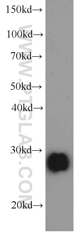 Western Blot (WB) analysis of human kidney tissue using Serum amyloid P component Monoclonal antibody (66084-1-Ig)