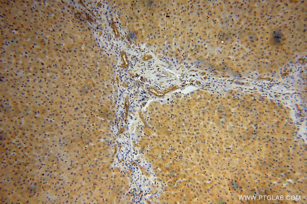 Immunohistochemistry (IHC) staining of human liver tissue using AARE Polyclonal antibody (14758-1-AP)