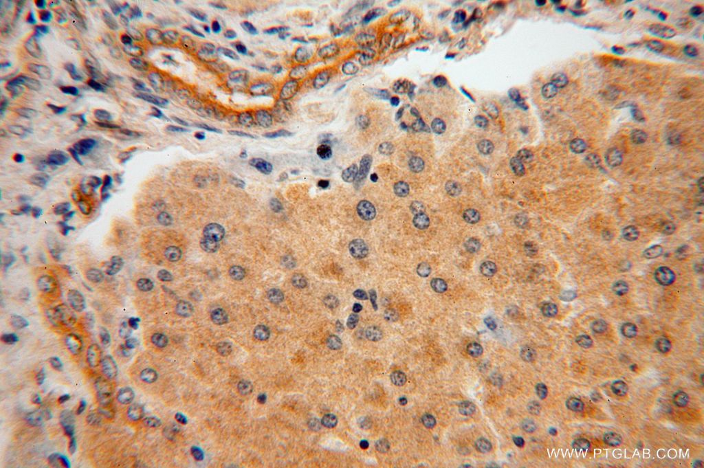 Immunohistochemistry (IHC) staining of human liver tissue using AARE Polyclonal antibody (14758-1-AP)