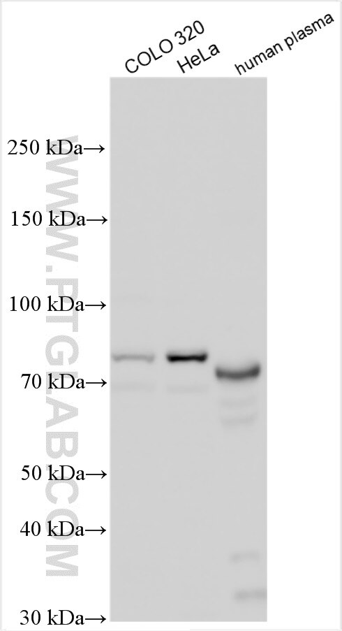 Western Blot (WB) analysis of various lysates using AARE Polyclonal antibody (14758-1-AP)