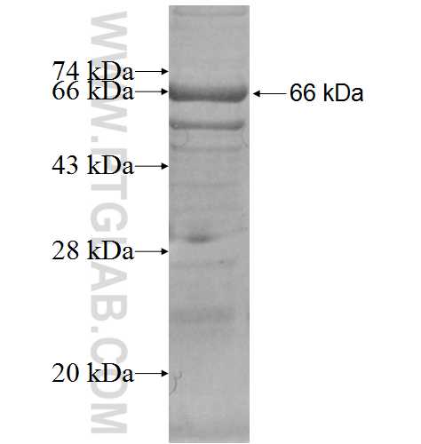 APEH fusion protein Ag6511 SDS-PAGE