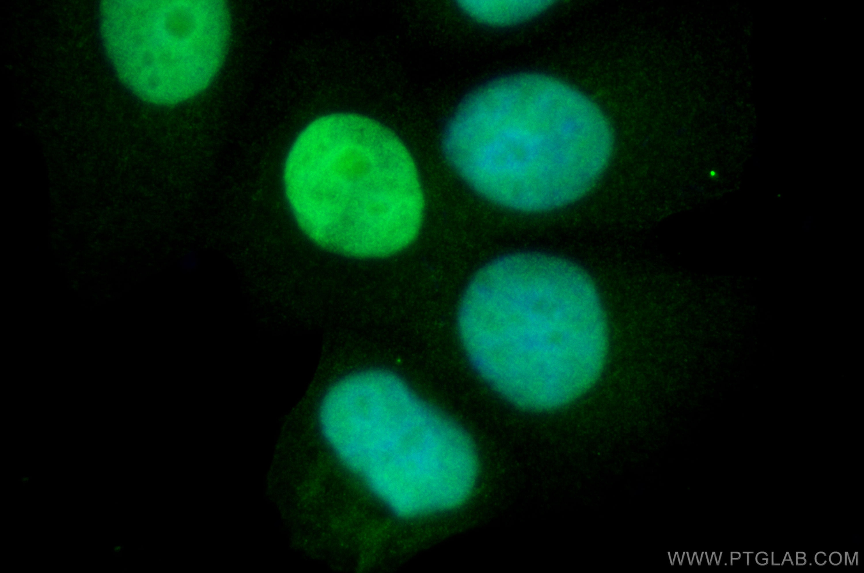 Immunofluorescence (IF) / fluorescent staining of MCF-7 cells using APEX1 Polyclonal antibody (10203-1-AP)