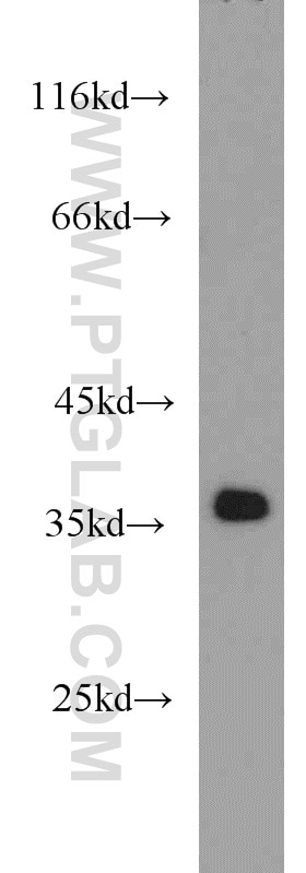 Western Blot (WB) analysis of mouse brain tissue using APEX1 Polyclonal antibody (10203-1-AP)