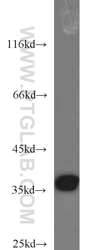 Western Blot (WB) analysis of HeLa cells using APEX1 Polyclonal antibody (10203-1-AP)