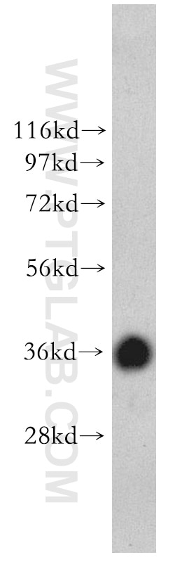 Western Blot (WB) analysis of mouse brain tissue using APEX1 Polyclonal antibody (10203-1-AP)