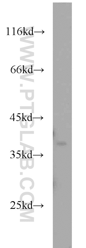 Western Blot (WB) analysis of HEK-293 cells using APEX1 Polyclonal antibody (10323-1-AP)