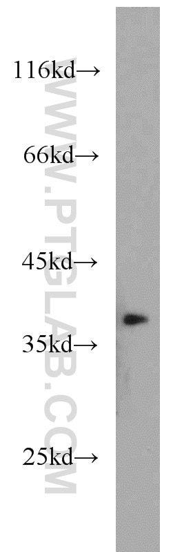Western Blot (WB) analysis of HEK-293 cells using APEX1 Polyclonal antibody (10323-1-AP)