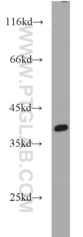 Western Blot (WB) analysis of K-562 cells using APEX1 Polyclonal antibody (10323-1-AP)