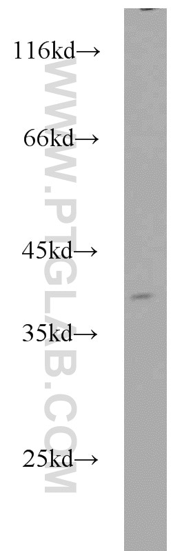 Western Blot (WB) analysis of K-562 cells using APEX1 Polyclonal antibody (10323-1-AP)