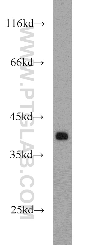 Western Blot (WB) analysis of Raji cells using APEX1 Polyclonal antibody (10323-1-AP)