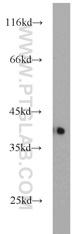 Western Blot (WB) analysis of Raji cells using APEX1 Polyclonal antibody (10323-1-AP)