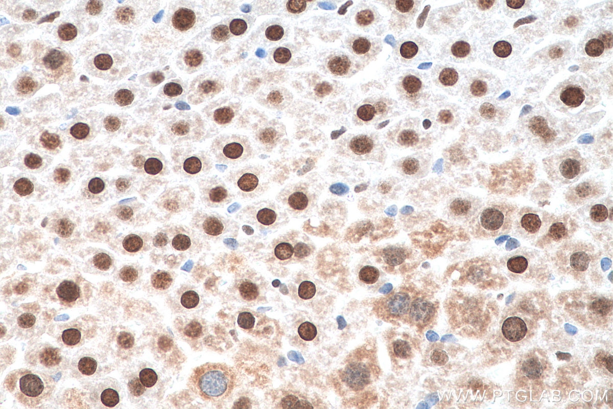 Immunohistochemistry (IHC) staining of mouse liver tissue using APEX1 Monoclonal antibody (67781-1-Ig)