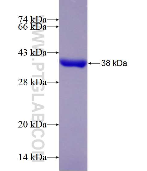 APEX1 fusion protein Ag28552 SDS-PAGE