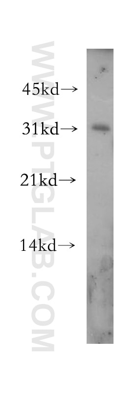 Western Blot (WB) analysis of HeLa cells using APH1A Polyclonal antibody (11643-1-AP)