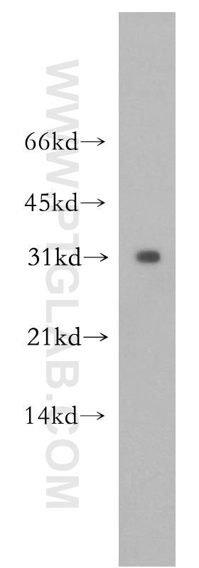 Western Blot (WB) analysis of human brain tissue using APH1A Polyclonal antibody (11643-1-AP)