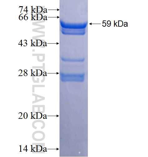 APH1A fusion protein Ag2238 SDS-PAGE