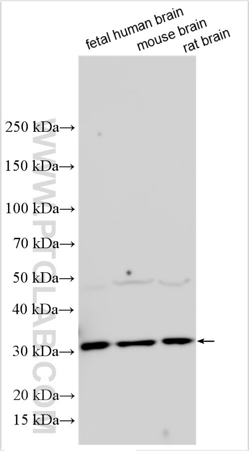 Western Blot (WB) analysis of various lysates using APH1B Polyclonal antibody (28175-1-AP)