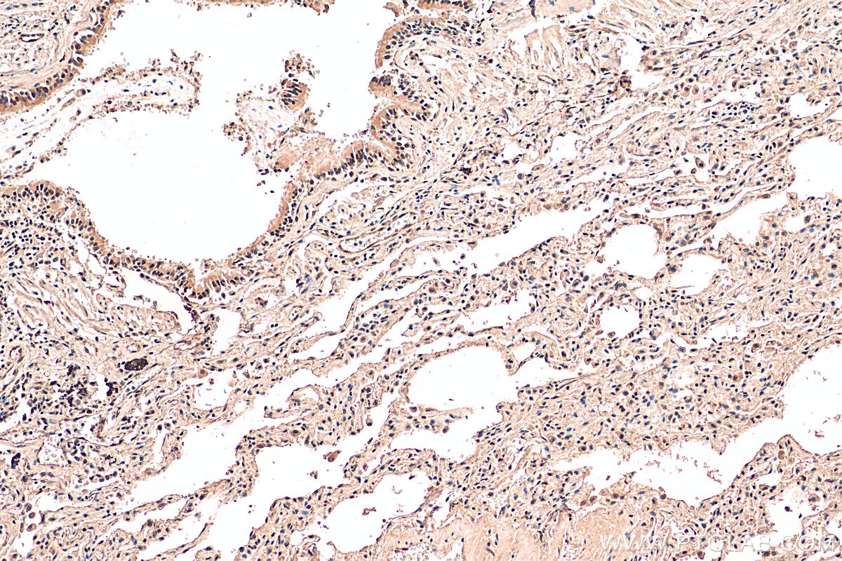 Immunohistochemistry (IHC) staining of human lung tissue using API5 Polyclonal antibody (25689-1-AP)