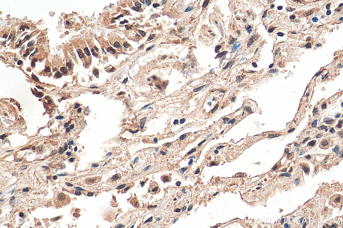 Immunohistochemistry (IHC) staining of human lung tissue using API5 Polyclonal antibody (25689-1-AP)
