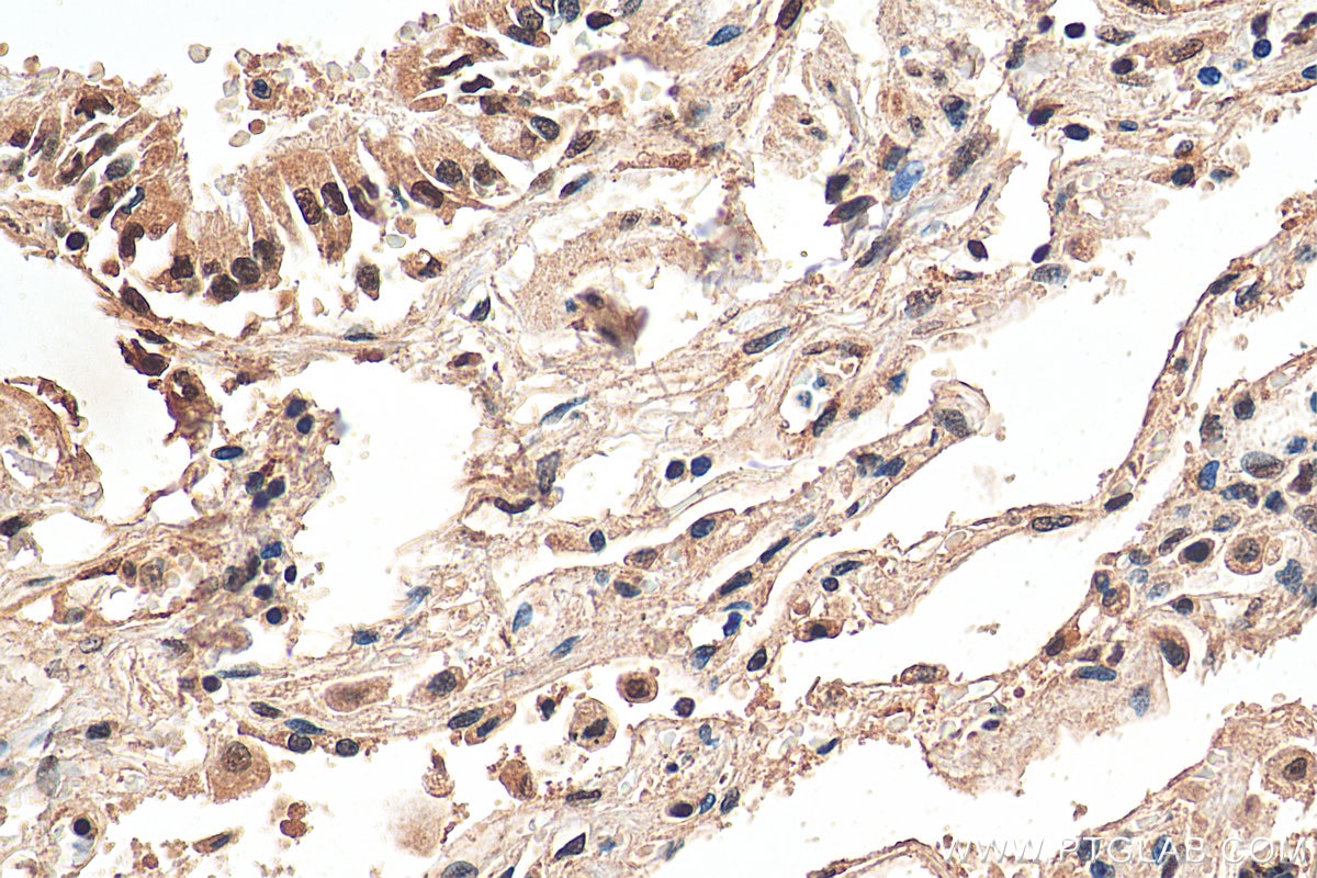 IHC staining of human lung using 25689-1-AP