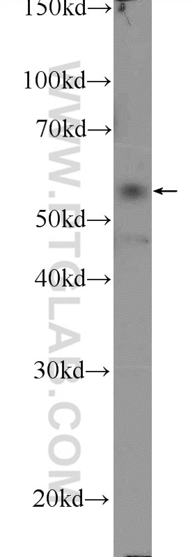 Western Blot (WB) analysis of MCF-7 cells using API5 Polyclonal antibody (25689-1-AP)