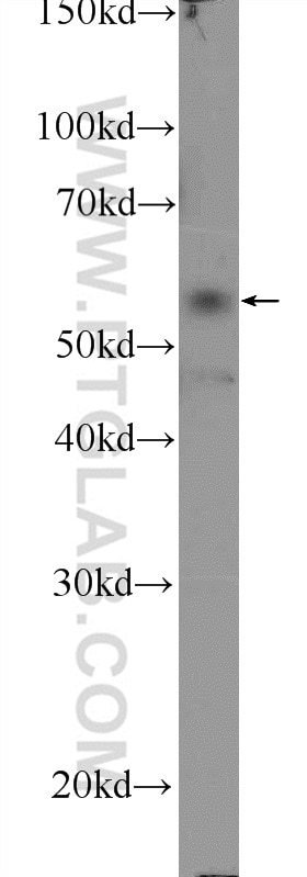 WB analysis of MCF-7 using 25689-1-AP