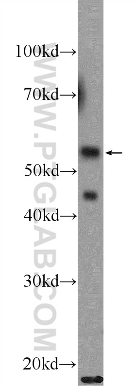 Western Blot (WB) analysis of NIH/3T3 cells using API5 Polyclonal antibody (25689-1-AP)