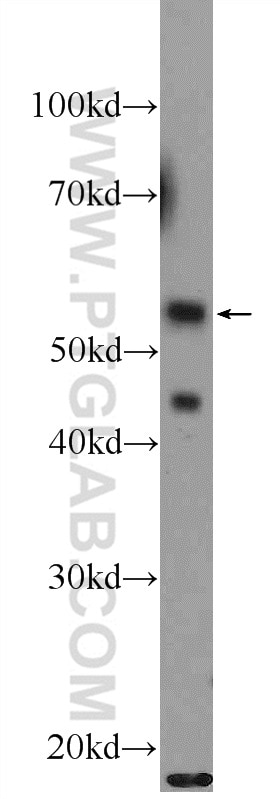 Western Blot (WB) analysis of NIH/3T3 cells using API5 Polyclonal antibody (25689-1-AP)