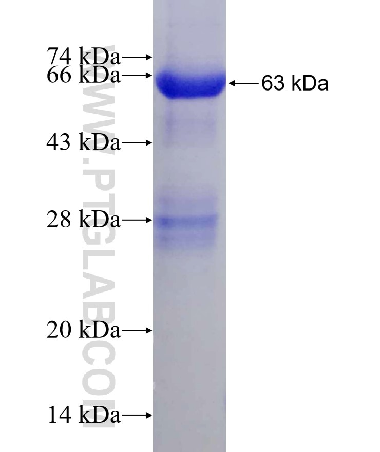 API5 fusion protein Ag22524 SDS-PAGE