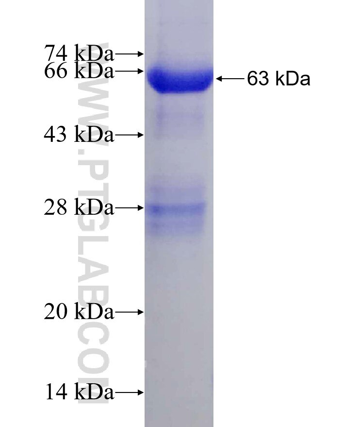 API5 fusion protein Ag22524 SDS-PAGE