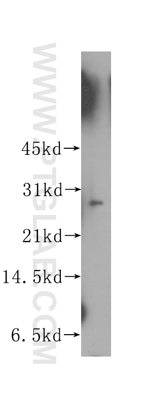 Western Blot (WB) analysis of human kidney tissue using APIP Polyclonal antibody (12089-2-AP)