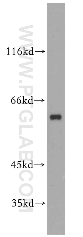 Western Blot (WB) analysis of PC-3 cells using APLF Polyclonal antibody (14252-1-AP)