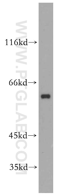 WB analysis of PC-3 using 14252-1-AP