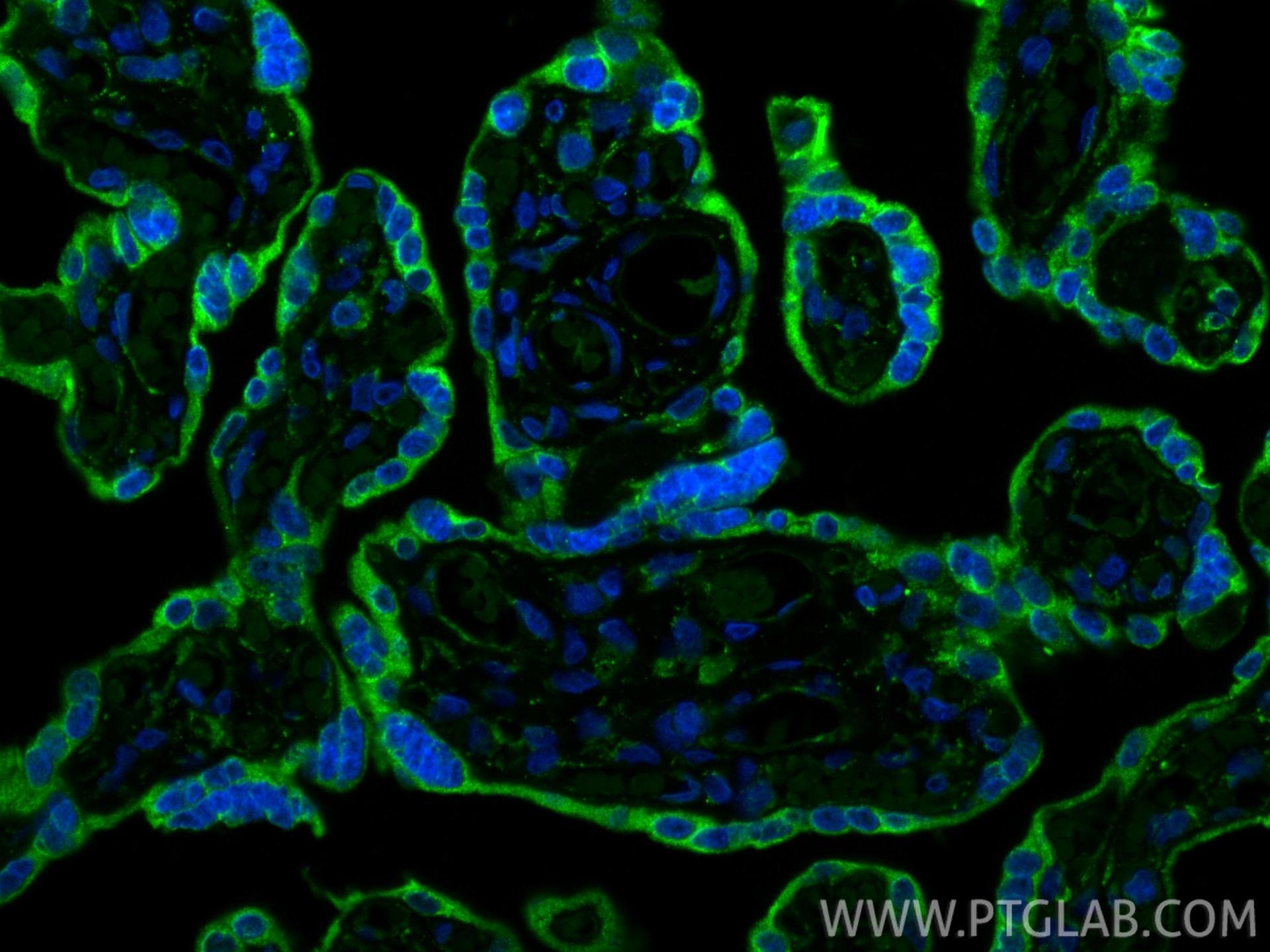 Immunofluorescence (IF) / fluorescent staining of human placenta tissue using Apelin Polyclonal antibody (11497-1-AP)